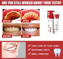 Ultra Probiotic Whitening Toothpaste for Cum Care